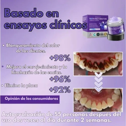 Polvo Teeth Restoration | La solución integral para una sonrisa más saludable