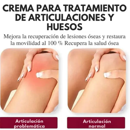 PerfectX™ Terapia Articular y Muscular